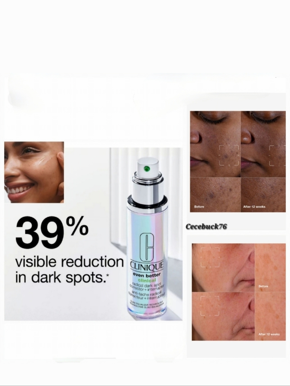 🌺Clinique Even Better Clinical Radical Dark Spot Corrector + Interrupter